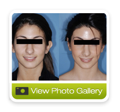 ear surgery gallery