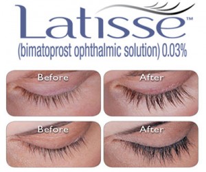 Latisse for Longer Fuller Lashes