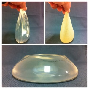 Silicone Gel Breast Implant