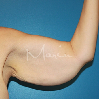 Photo Gallery of Marin Aesthetics in La Jolla San Diego California