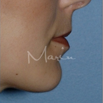 Photo Gallery of Marin Aesthetics in La Jolla San Diego California