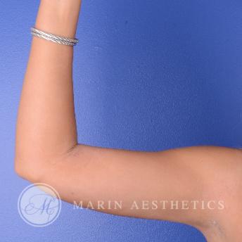 Photo Gallery of Marin Aesthetics in La Jolla San Diego California