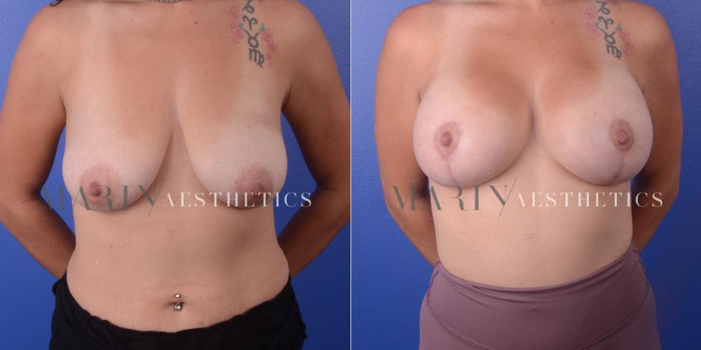 Before and After Photo