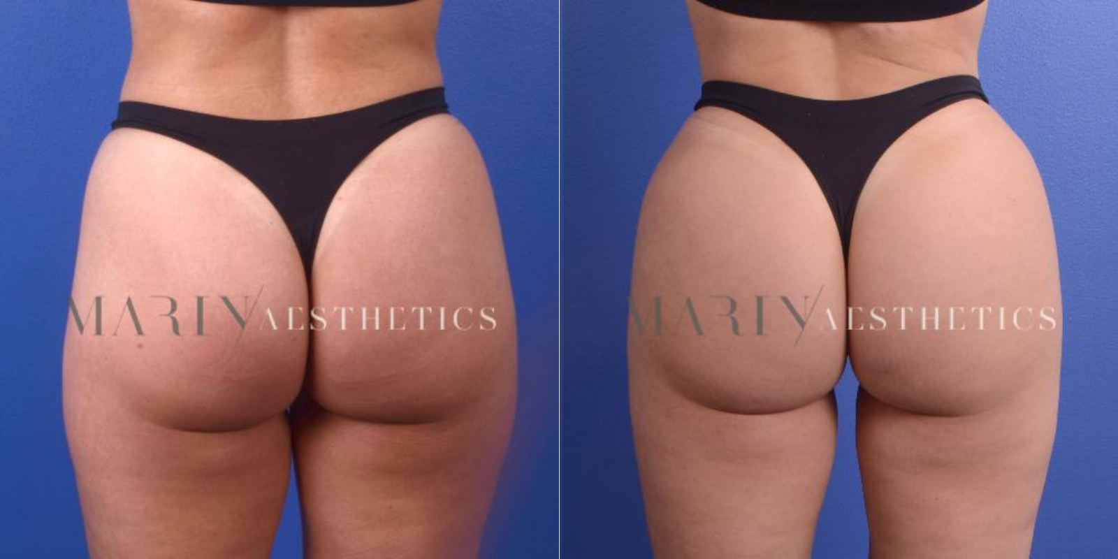 Before and After Photo