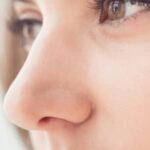 rhinoplasty anti-aging effect