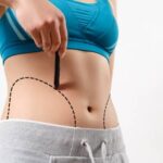 liposuction improvements