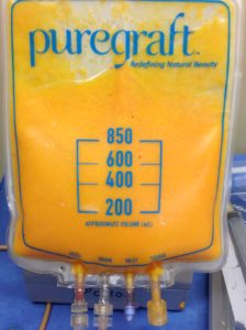 puregraft