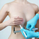 breast asymmetry treatment featured