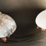 breast implant sizes