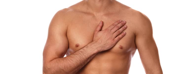 causes of gynecomastia