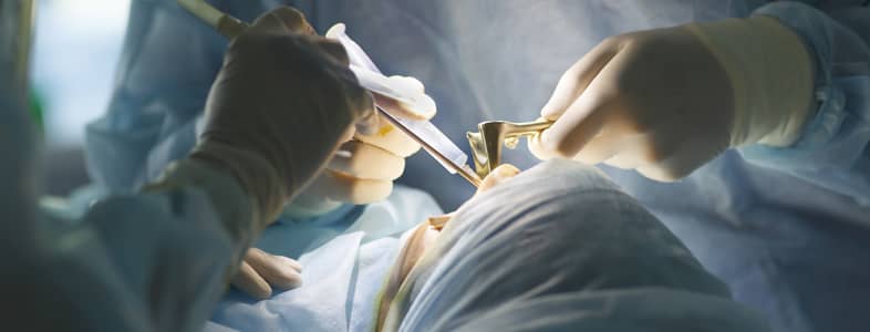 open close rhinoplasty incision