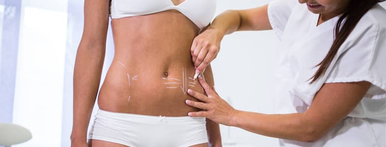 Abdominoplasty and Liposuction Thighs and Flanks Case 92109 - The Plastic Surgery Group
