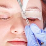 eyelid surgery revision