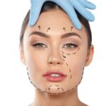 revision plastic surgery cost