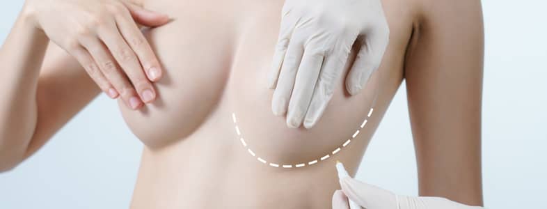 top plastic surgery trend 2014