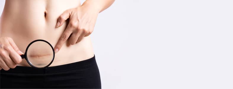 tummy tuck side effects