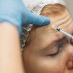 how does preventative Botox work