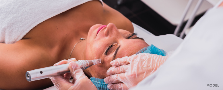 Microneedling San Diego