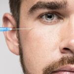 Facelift for Men: The Art of Manly Rejuvenation