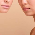 Radiesse vs. Sculptra: Exploring the Differences