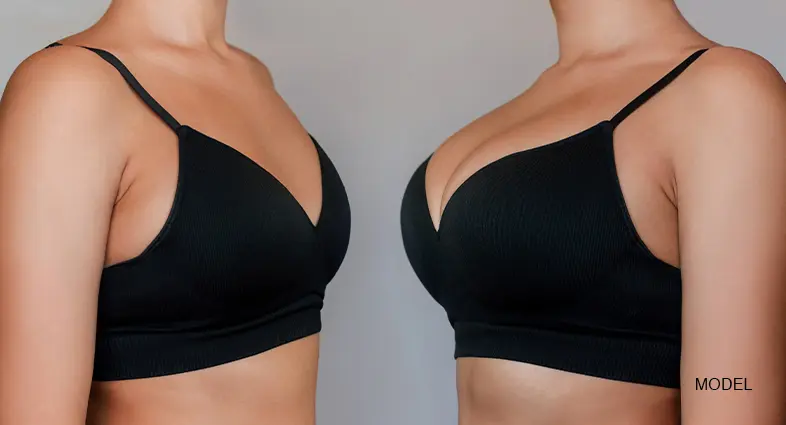 Breast Lift Vs Breast Augmentation