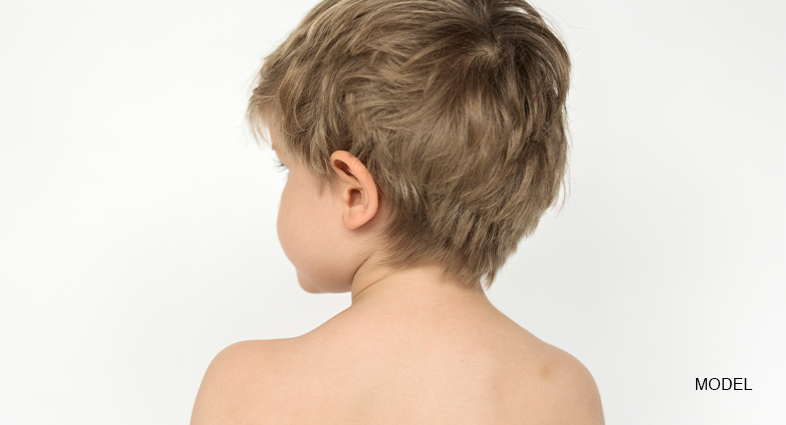 Otoplasty For Children
