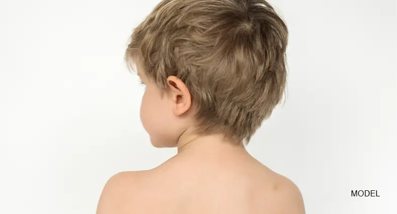 Otoplasty For Children
