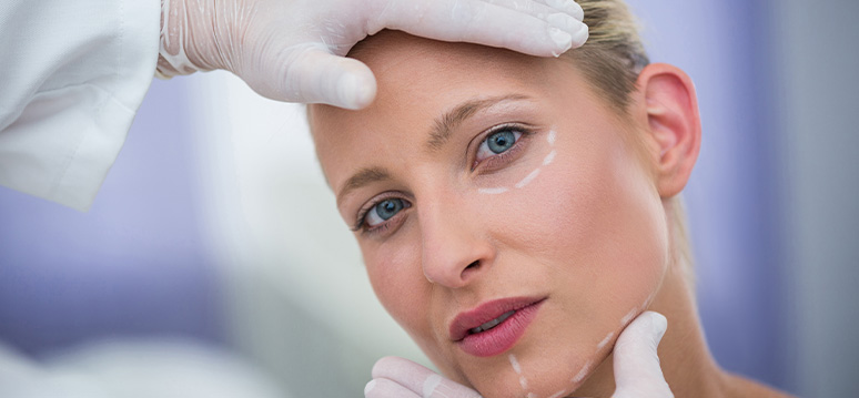How long Does A Facelift Last