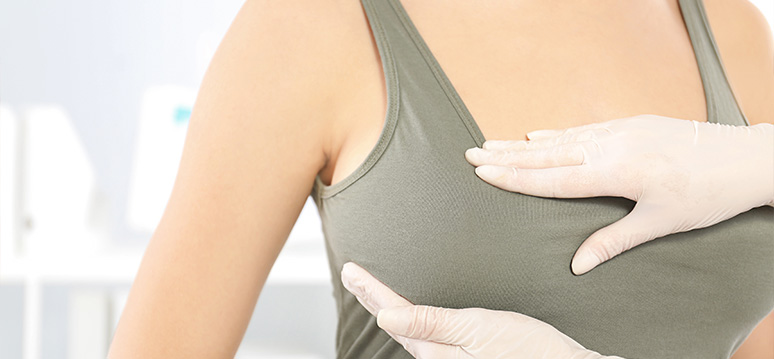 Breast Augmentation and Breast Feeding