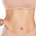 Tummy Tuck 10 Years Later