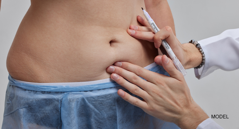 How Long Does Fat Grafting Last