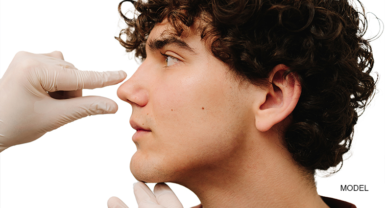 Non Surgical Rhinoplasty