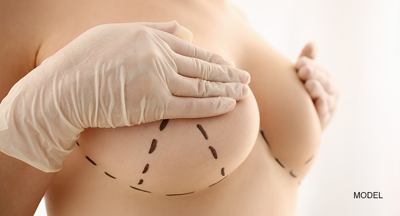 Breast Lift San Diego