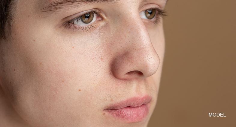 Rhinoplasty Before And After