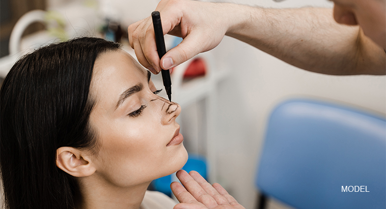 Asymmetric Nasal Bridge Surgery La Jolla