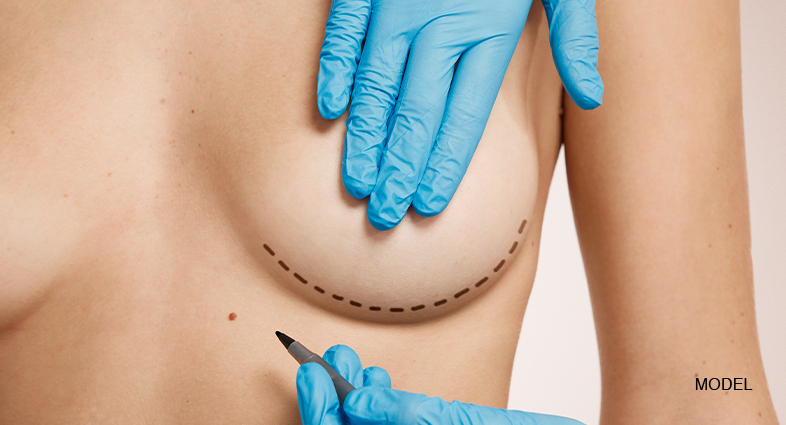Breast Procedures San Diego